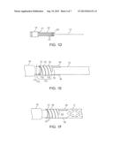 Stent Holding Fixtures diagram and image