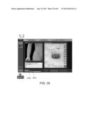 SHOWING SKIN LESION INFORMATION diagram and image