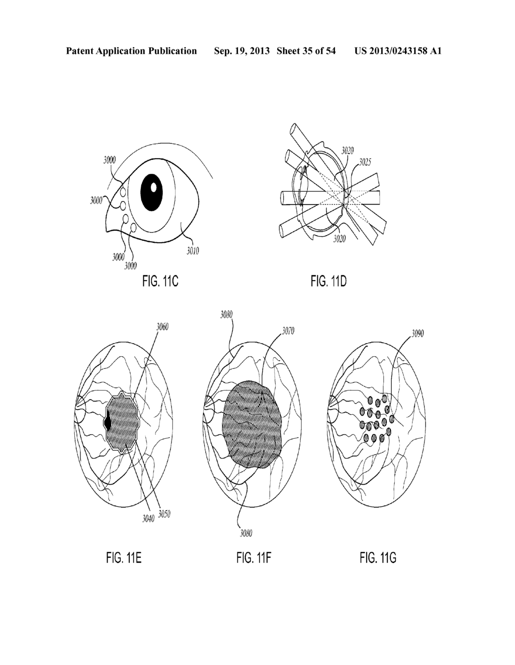 ORTHOVOLTAGE RADIOSURGERY - diagram, schematic, and image 36