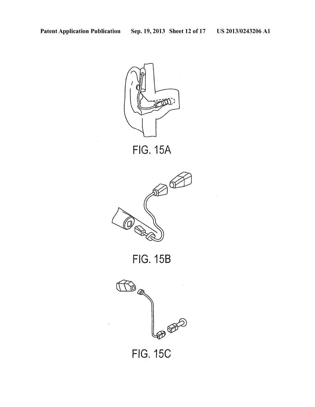 EARHEALTH MONITORING SYSTEM AND METHOD IV - diagram, schematic, and image 13