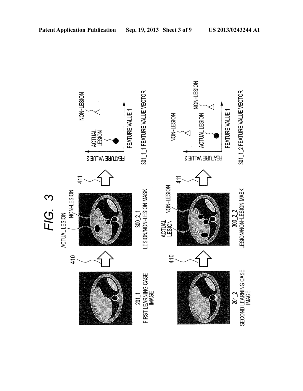 Apparatus, Method, and Computer Program Product for Medical Diagnostic     Imaging Assistance - diagram, schematic, and image 04