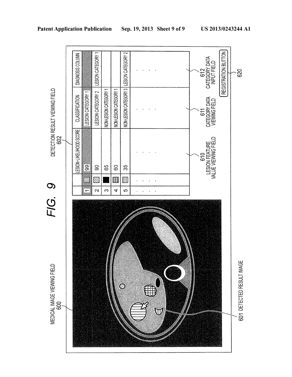 Apparatus, Method, and Computer Program Product for Medical Diagnostic     Imaging Assistance - diagram, schematic, and image 10