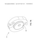 Method of Forming a Can End Having a Moveable Portion diagram and image