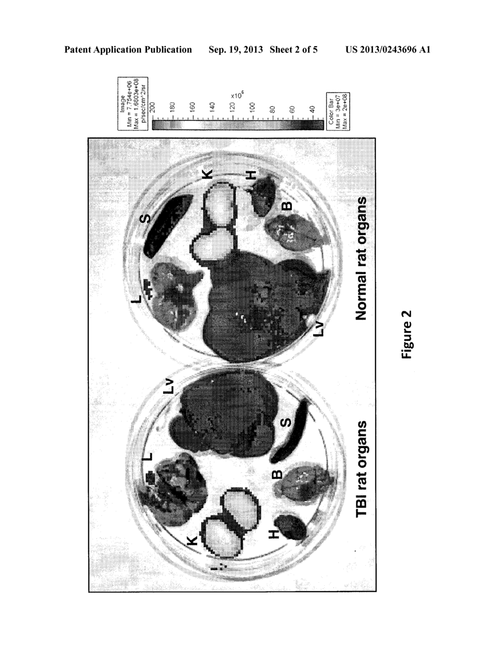 Compositions and Methods for the Treatment of Traumatic Brain Injury - diagram, schematic, and image 03