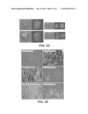 RNA INTERFERENCE FOR THE TREATMENT OF HEART FAILURE diagram and image