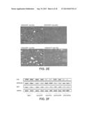 RNA INTERFERENCE FOR THE TREATMENT OF HEART FAILURE diagram and image