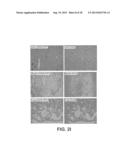 RNA INTERFERENCE FOR THE TREATMENT OF HEART FAILURE diagram and image