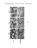 Methods for Treating Diseases and HSV Using Antibodies to     Aminophospholipids diagram and image