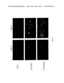 Methods for Treating Diseases and HSV Using Antibodies to     Aminophospholipids diagram and image