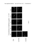 Methods for Treating Diseases and HSV Using Antibodies to     Aminophospholipids diagram and image