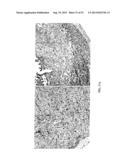 Methods for Treating Diseases and HSV Using Antibodies to     Aminophospholipids diagram and image