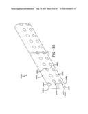 Rod or Wire Having Discontinous Cross Sections, and Implements Made from     Such Rod or Wire diagram and image