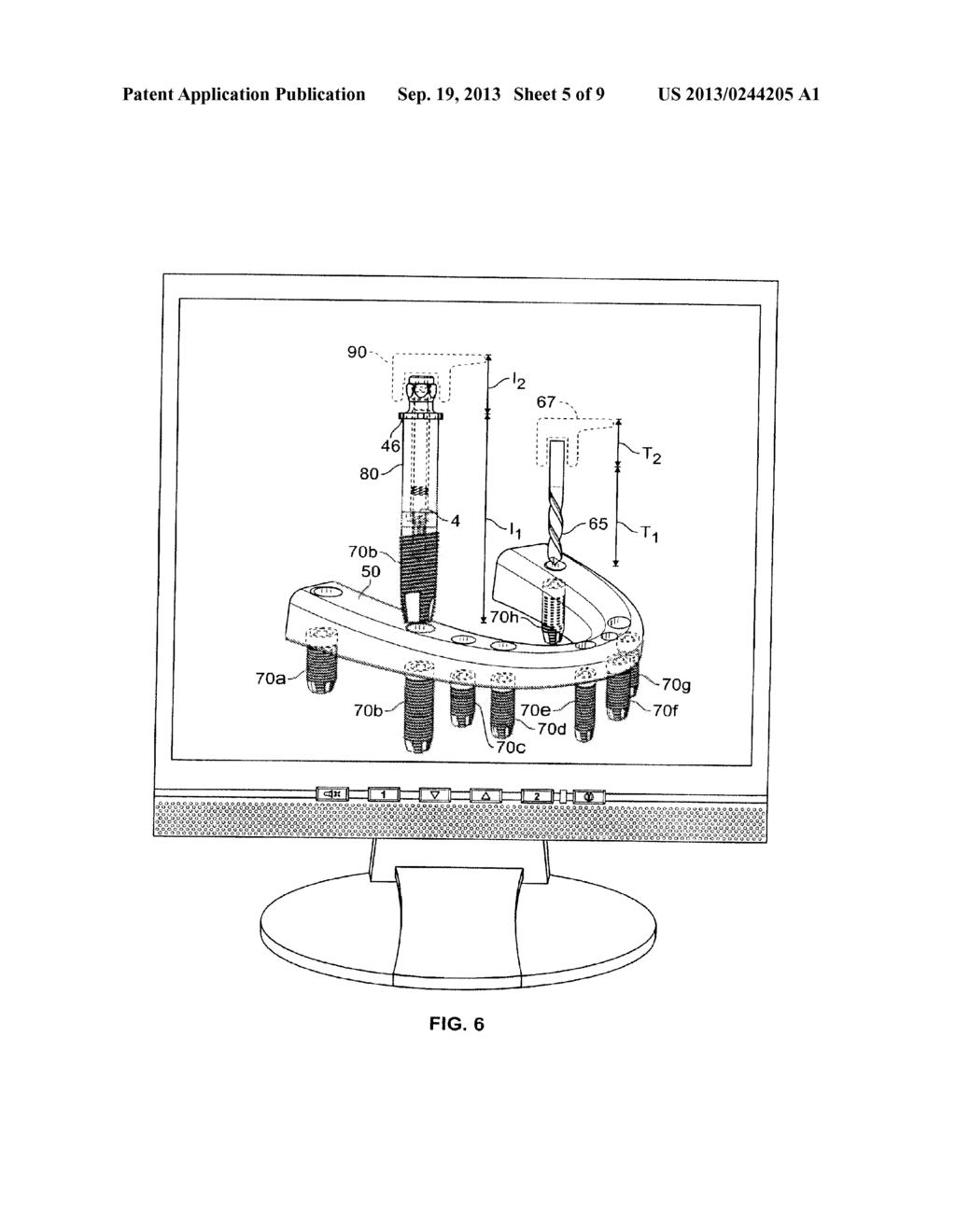 Method For Pre-Operative Visualization Of Instrumentation Used With A     Surgical Guide For Dental Implant Placement - diagram, schematic, and image 06