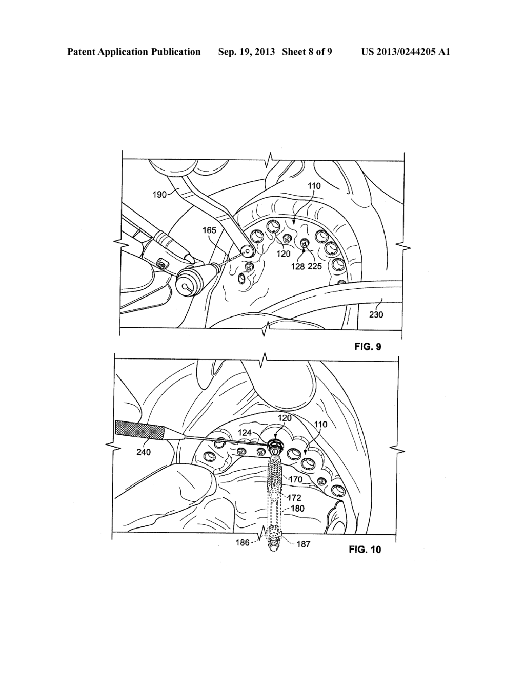 Method For Pre-Operative Visualization Of Instrumentation Used With A     Surgical Guide For Dental Implant Placement - diagram, schematic, and image 09