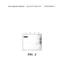 OVEREXPRESSION OF PHYTASE GENES IN YEAST SYSTEMS diagram and image