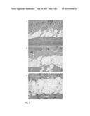 HYALURONIC ACID-COLLAGEN MATRICES FOR DERMAL FILLING AND VOLUMIZING     APPLICATIONS diagram and image