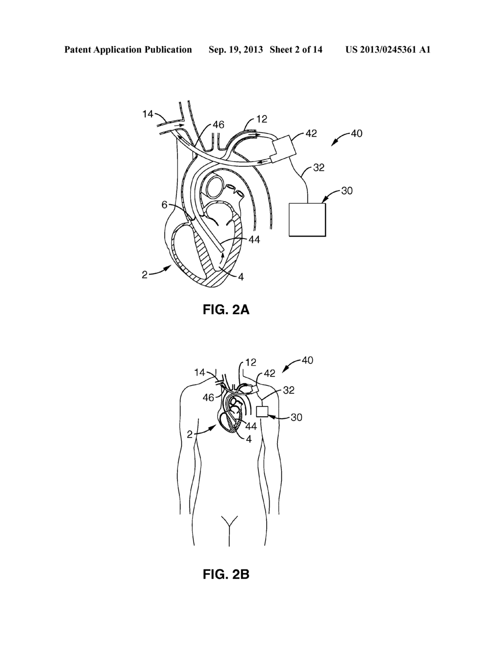 HEART ASSIST DEVICE - diagram, schematic, and image 03