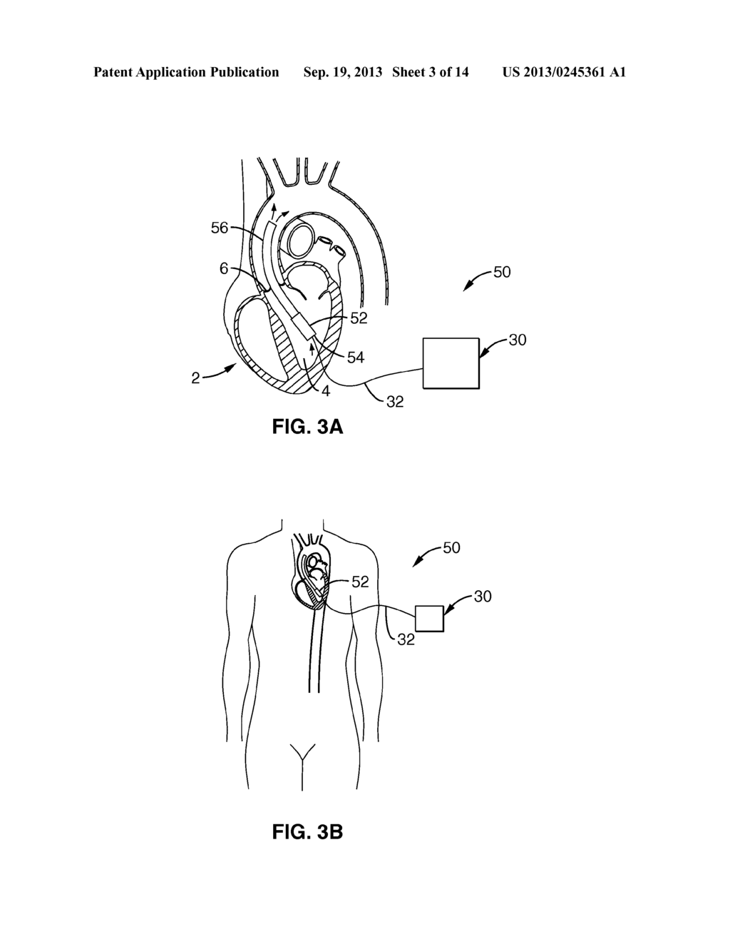 HEART ASSIST DEVICE - diagram, schematic, and image 04