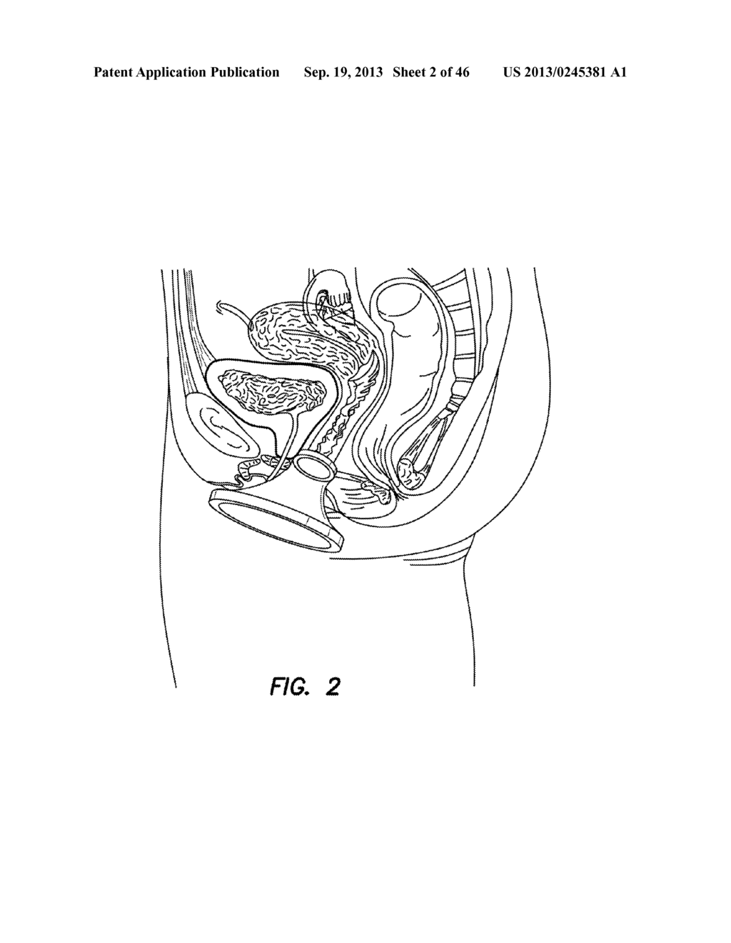 NATURAL ORIFICE SURGERY SYSTEM - diagram, schematic, and image 03