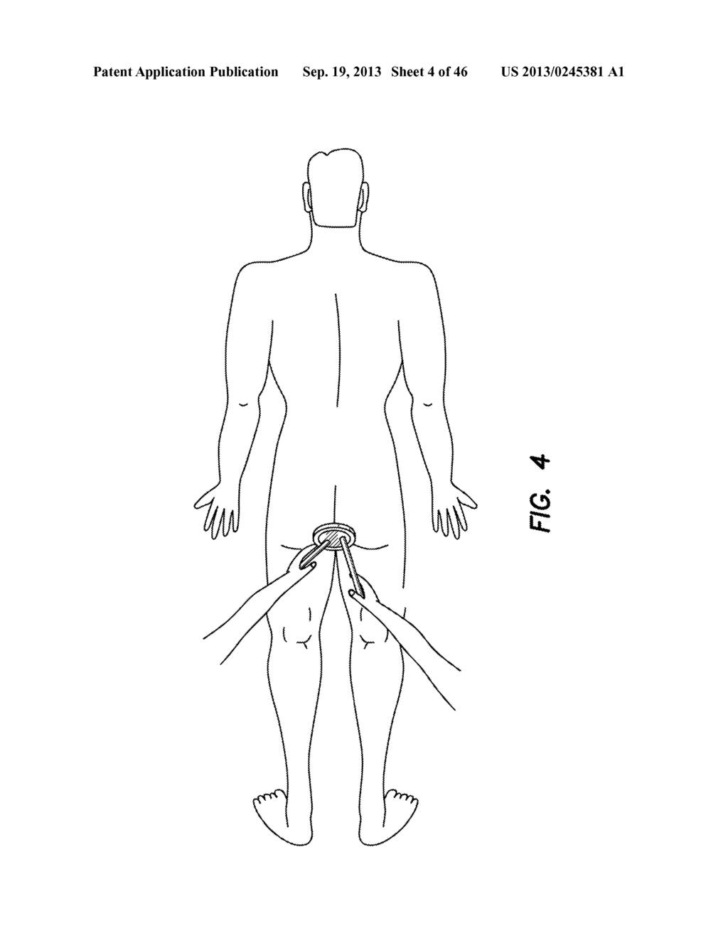 NATURAL ORIFICE SURGERY SYSTEM - diagram, schematic, and image 05