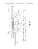 CATHETER SYSTEMS FOR CROSSING TOTAL OCCLUSIONS IN VASCULATURE diagram and image