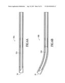 CATHETER SYSTEMS FOR CROSSING TOTAL OCCLUSIONS IN VASCULATURE diagram and image