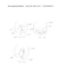 FETAL MONITORING DEVICE AND METHODS diagram and image