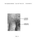 HYPERSPECTRAL IMAGING IN DIABETES AND PERIPHERAL VASCULAR DISEASE diagram and image