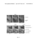 HYPERSPECTRAL IMAGING IN DIABETES AND PERIPHERAL VASCULAR DISEASE diagram and image