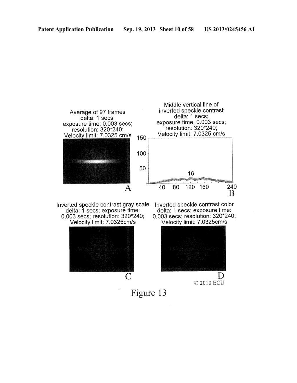 Methods, Systems and Computer Program Products for Non-Invasive     Determination of Blood Flow Distribution Using Speckle Imaging Techniques     and Hemodynamic Modeling - diagram, schematic, and image 11