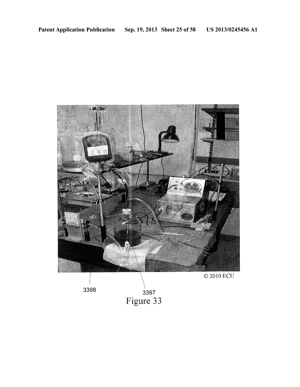 Methods, Systems and Computer Program Products for Non-Invasive     Determination of Blood Flow Distribution Using Speckle Imaging Techniques     and Hemodynamic Modeling - diagram, schematic, and image 26