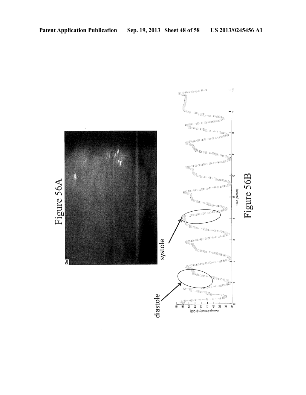 Methods, Systems and Computer Program Products for Non-Invasive     Determination of Blood Flow Distribution Using Speckle Imaging Techniques     and Hemodynamic Modeling - diagram, schematic, and image 49