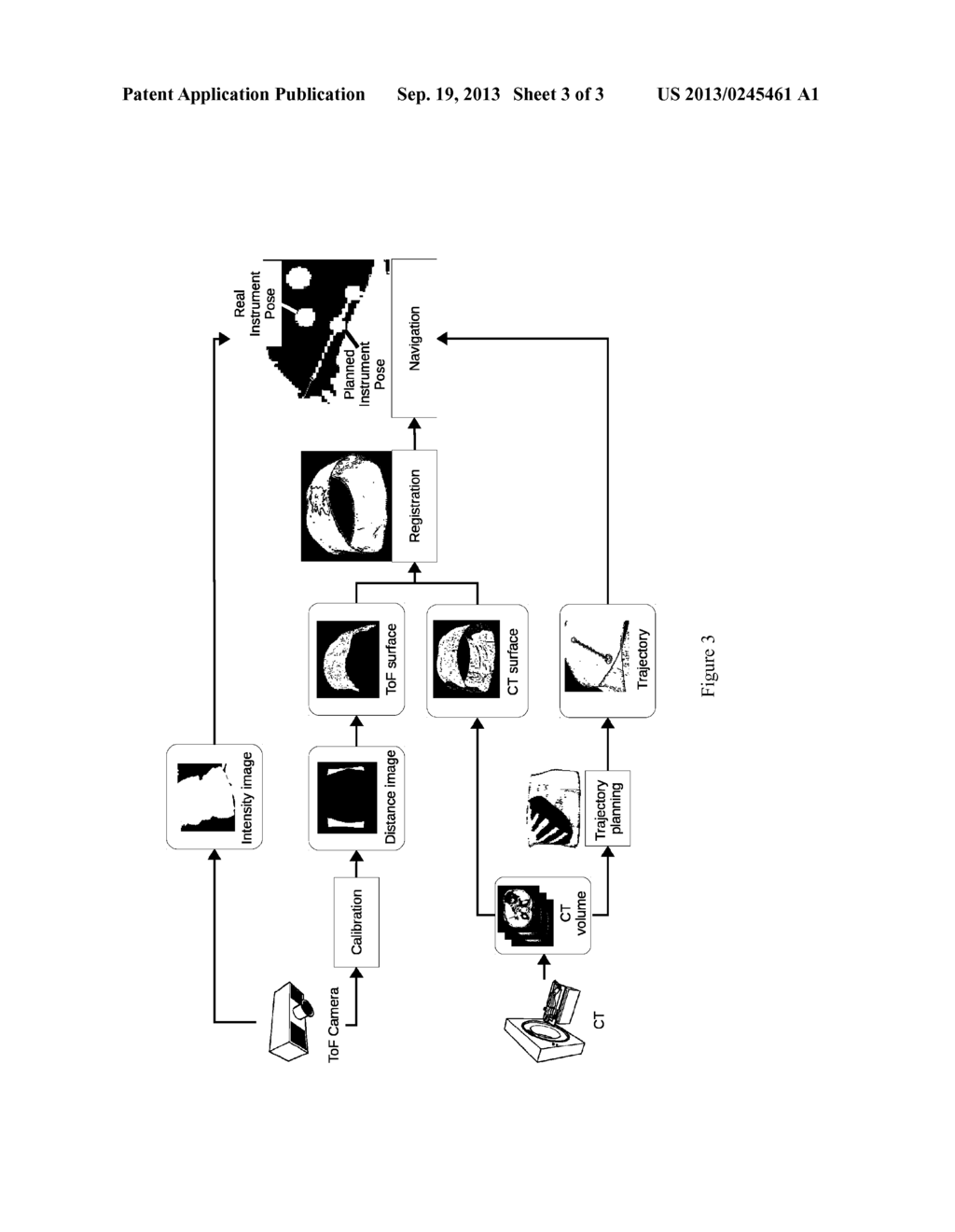 Visualization of Anatomical Data by Augmented Reality - diagram, schematic, and image 04