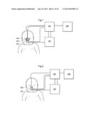 APPARATUS AND METHOD FOR THE COLLECTION OF SAMPLES OF EXHALED AIR diagram and image