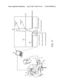 MINIMALLY INVASIVE DETERMINATION OF COLLATERAL VENTILATION IN LUNGS diagram and image