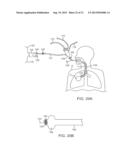 MINIMALLY INVASIVE DETERMINATION OF COLLATERAL VENTILATION IN LUNGS diagram and image