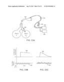 MINIMALLY INVASIVE DETERMINATION OF COLLATERAL VENTILATION IN LUNGS diagram and image