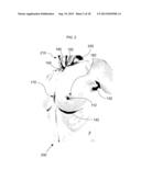 METHOD FOR FACILITATING BREAST IMPLANT PROCEDURE DECISIONS diagram and image