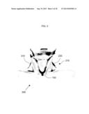 METHOD FOR FACILITATING BREAST IMPLANT PROCEDURE DECISIONS diagram and image