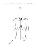 METHOD FOR FACILITATING BREAST IMPLANT PROCEDURE DECISIONS diagram and image