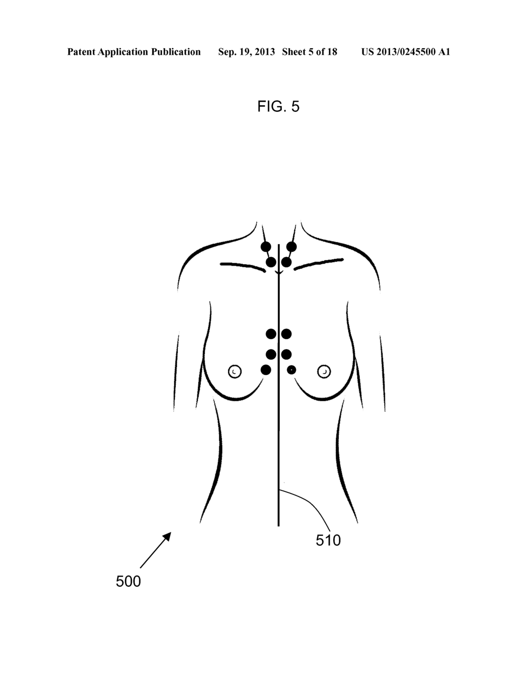 METHOD FOR FACILITATING BREAST IMPLANT PROCEDURE DECISIONS - diagram, schematic, and image 06