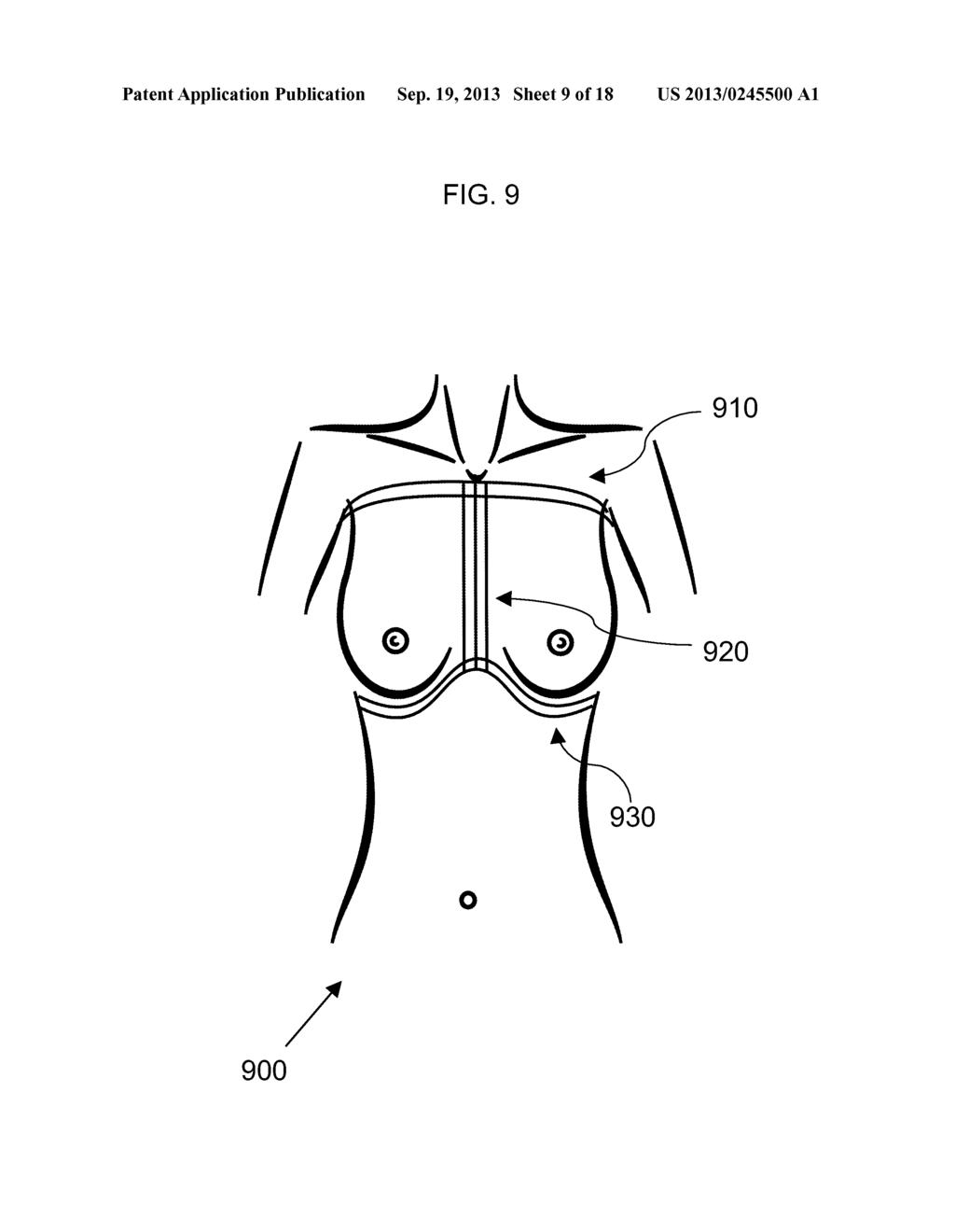 METHOD FOR FACILITATING BREAST IMPLANT PROCEDURE DECISIONS - diagram, schematic, and image 10