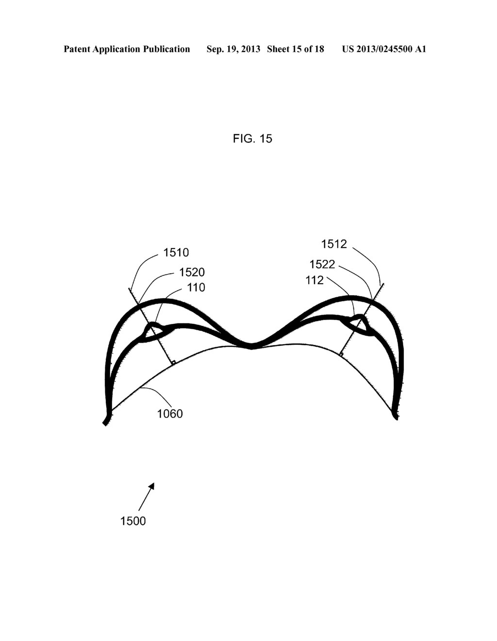 METHOD FOR FACILITATING BREAST IMPLANT PROCEDURE DECISIONS - diagram, schematic, and image 16