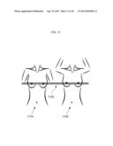 METHOD FOR FACILITATING BREAST IMPLANT PROCEDURE DECISIONS diagram and image