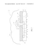 OCULAR IMPLANT SYSTEM diagram and image