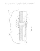 OCULAR IMPLANT SYSTEM diagram and image