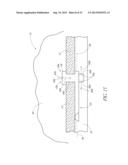 OCULAR IMPLANT SYSTEM diagram and image