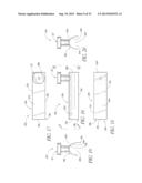 OCULAR IMPLANT SYSTEM diagram and image