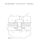 OCULAR IMPLANT SYSTEM diagram and image