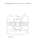 OCULAR IMPLANT SYSTEM diagram and image